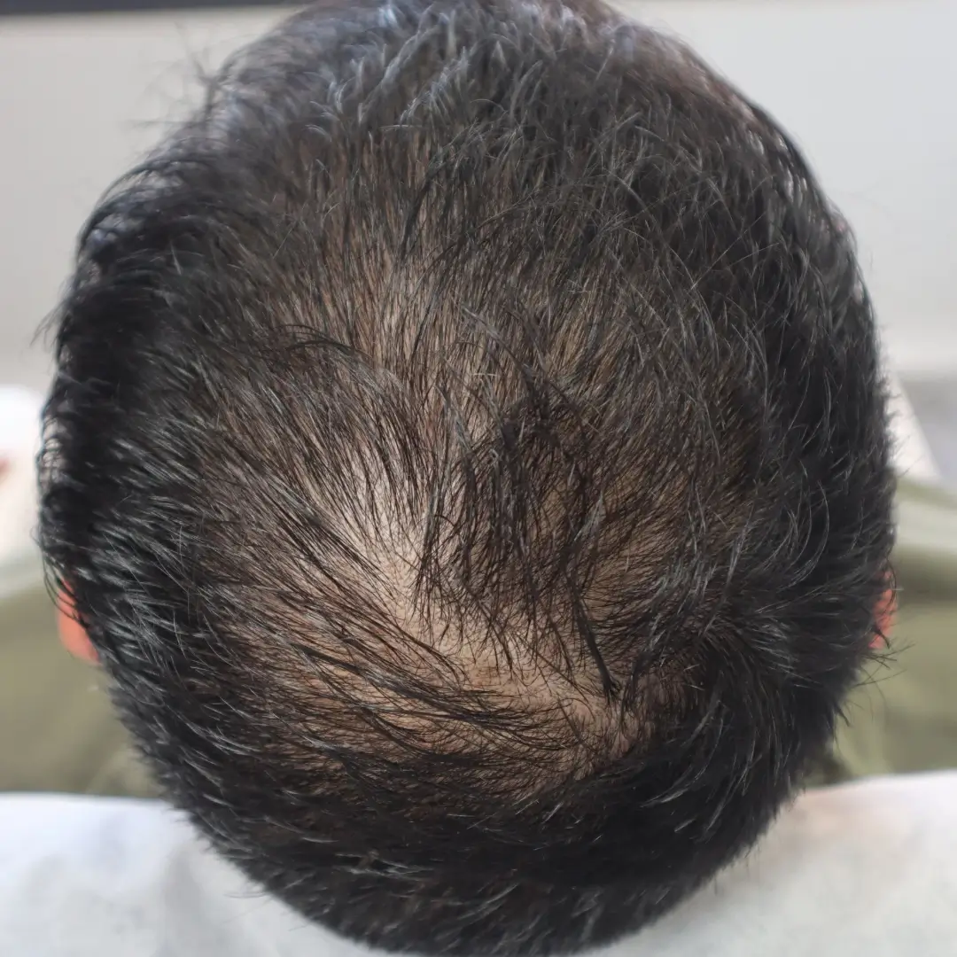 Before